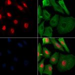 Phospho-SAMHD1 (Thr592) Antibody in Immunocytochemistry (ICC/IF)