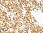 Phospho-SHP2 (Tyr580) Antibody in Immunohistochemistry (Paraffin) (IHC (P))