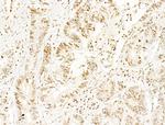 Phospho-SHP2 (Tyr580) Antibody in Immunohistochemistry (Paraffin) (IHC (P))