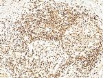 Phospho-SHP2 (Tyr580) Antibody in Immunohistochemistry (Paraffin) (IHC (P))