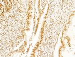 Phospho-SHP2 (Tyr580) Antibody in Immunohistochemistry (Paraffin) (IHC (P))