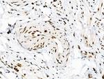 Phospho-SMAD5 (Ser463, Ser465) Antibody in Immunohistochemistry (Paraffin) (IHC (P))