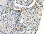 Phospho-SMAD5 (Ser463, Ser465) Antibody in Immunohistochemistry (Paraffin) (IHC (P))