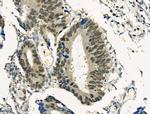 Phospho-SNAIL (Ser11) Antibody in Immunohistochemistry (Paraffin) (IHC (P))