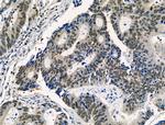 Phospho-SNAIL (Ser11) Antibody in Immunohistochemistry (Paraffin) (IHC (P))