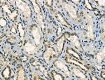 Phospho-SNAIL (Ser11) Antibody in Immunohistochemistry (Paraffin) (IHC (P))