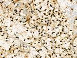 Phospho-SNAIL (Ser11) Antibody in Immunohistochemistry (Paraffin) (IHC (P))