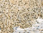 Phospho-SNAIL (Ser11) Antibody in Immunohistochemistry (Paraffin) (IHC (P))