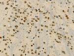 Phospho-SNAIL (Ser11) Antibody in Immunohistochemistry (Paraffin) (IHC (P))