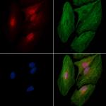 Phospho-SRPK2 (Thr492) Antibody in Immunocytochemistry (ICC/IF)