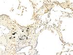 Phospho-STAT5A/B (Tyr694) Antibody in Immunohistochemistry (Paraffin) (IHC (P))