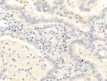 Phospho-STAT5A/B (Tyr694) Antibody in Immunohistochemistry (Paraffin) (IHC (P))