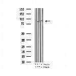 Phospho-STAT5A/B (Tyr694) Antibody in Western Blot (WB)