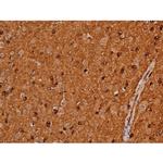 Phospho-Tau (Ser579) Antibody in Immunohistochemistry (Paraffin) (IHC (P))