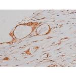 Phospho-Tau (Ser579) Antibody in Immunohistochemistry (Paraffin) (IHC (P))