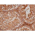 Phospho-Tau (Ser579) Antibody in Immunohistochemistry (Paraffin) (IHC (P))