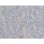 Phospho-Tau (Ser673) Antibody in Immunohistochemistry (Paraffin) (IHC (P))