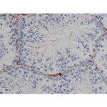 Phospho-Tau (Ser673) Antibody in Immunohistochemistry (Paraffin) (IHC (P))