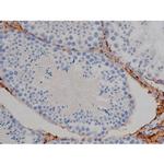 Phospho-Tau (Ser673) Antibody in Immunohistochemistry (Paraffin) (IHC (P))