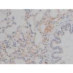 Phospho-Tau (Ser673) Antibody in Immunohistochemistry (Paraffin) (IHC (P))