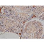 Phospho-Tau (Ser721) Antibody in Immunohistochemistry (Paraffin) (IHC (P))