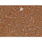 Phospho-Tau (Ser721) Antibody in Immunohistochemistry (Paraffin) (IHC (P))