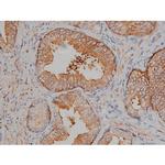 Phospho-Tau (Ser721) Antibody in Immunohistochemistry (Paraffin) (IHC (P))