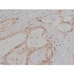 Phospho-Tau (Ser721) Antibody in Immunohistochemistry (Paraffin) (IHC (P))