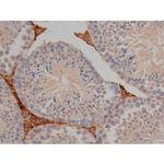 Phospho-Tau (Ser721) Antibody in Immunohistochemistry (Paraffin) (IHC (P))