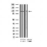 Phospho-Tau (Ser721) Antibody in Western Blot (WB)