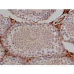 Phospho-Tau (Ser739) Antibody in Immunohistochemistry (Paraffin) (IHC (P))