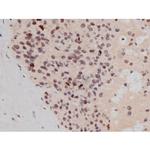 Phospho-Tau (Thr498) Antibody in Immunohistochemistry (Paraffin) (IHC (P))