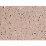 Phospho-Tau (Thr498) Antibody in Immunohistochemistry (Paraffin) (IHC (P))