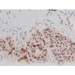 Phospho-Tau (Thr498) Antibody in Immunohistochemistry (Paraffin) (IHC (P))