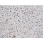 Phospho-Tau (Thr498) Antibody in Immunohistochemistry (Paraffin) (IHC (P))