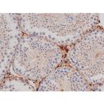 Phospho-Tau (Thr498) Antibody in Immunohistochemistry (Paraffin) (IHC (P))