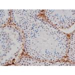 Phospho-Tau (Thr522) Antibody in Immunohistochemistry (Paraffin) (IHC (P))