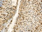 Phospho-TDP-43 (Ser409, Ser410) Antibody in Immunohistochemistry (Paraffin) (IHC (P))