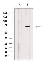 Phospho-TGFBR2 (Ser553) Antibody in Western Blot (WB)