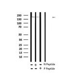 Phospho-TSC2 (Ser939) Antibody in Western Blot (WB)