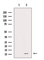 Phospho-UBA52 (Ser65) Antibody in Western Blot (WB)