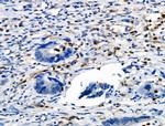 Phospho-Vimentin (Ser39) Antibody in Immunohistochemistry (Paraffin) (IHC (P))