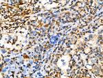 Phospho-Vimentin (Ser39) Antibody in Immunohistochemistry (Paraffin) (IHC (P))