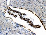 Phospho-Vimentin (Ser39) Antibody in Immunohistochemistry (Paraffin) (IHC (P))