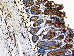 Phospho-Vimentin (Ser39) Antibody in Immunohistochemistry (Paraffin) (IHC (P))