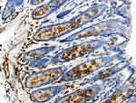 Phospho-Vimentin (Ser39) Antibody in Immunohistochemistry (Paraffin) (IHC (P))