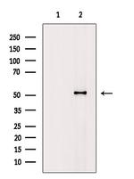 Phospho-Vimentin (Ser39) Antibody in Western Blot (WB)