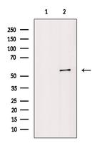 Phospho-Vimentin (Ser39) Antibody in Western Blot (WB)