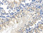 Phospho-WNK4 (Ser575) Antibody in Immunohistochemistry (Paraffin) (IHC (P))