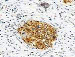 Phospho-ZO-2 (Tyr1118) Antibody in Immunohistochemistry (Paraffin) (IHC (P))